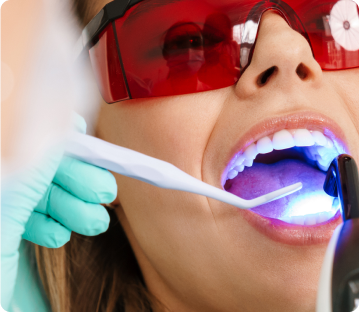 paciente de Sanitas Dental recibiendo un tratamiento bucodental con luz azul